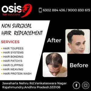 Osis hair solutions rajahmundry
